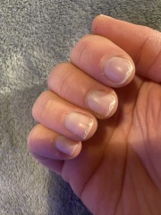 Flaky nails…help!