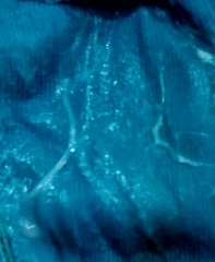 Is this early pregnancy discharge?