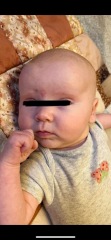 Possible milk allergy or what?