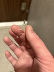 Graphic image. Is this implantation bleeding ?