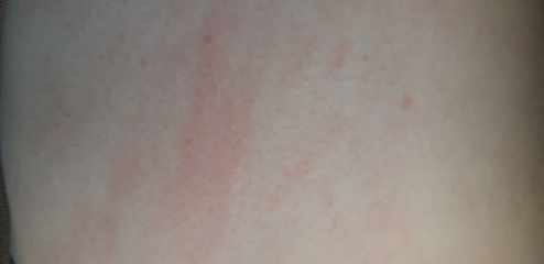 Photos - my abdomen
