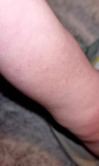 Spots?