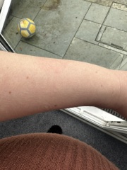 What this come up on my arm pics