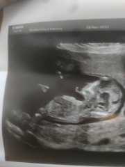 Any guesses boy or girl on my 12 weeks 6 days scan?