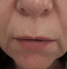 Help my lines and lips!! Pic attached…