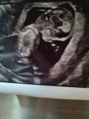 Nub theory - 12 weeks