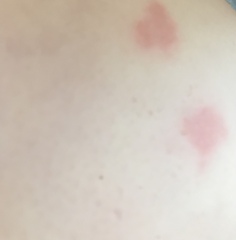 What are these spot things?