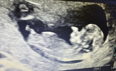 July / August babies let’s see your scans!