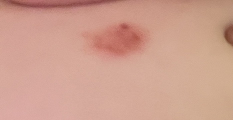 Does this look/sound like eczema?