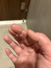 Graphic image. Is this implantation bleeding ?