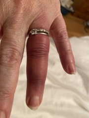 Do I need to get my rings cut off ?