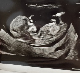 Boy or girl nub theory?? Xxxxx