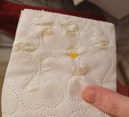 Ovulation? Help me