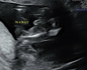 Potty shot at 16 weeks - has yours been wrong?