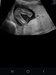 Is it REALLY looking like a girl?? May I have your opinion please?