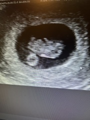 Due September 2024 PART 3 ❤️🩷💛💚💙💜