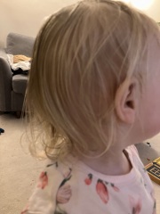 What to do about this baby bed head?