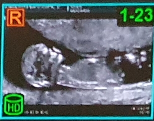 Gender/Nub Guesses (3pics).