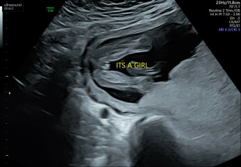 Is it REALLY looking like a girl?? May I have your opinion please?