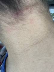 Does this need antibiotics?