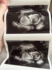 May 24 FTM