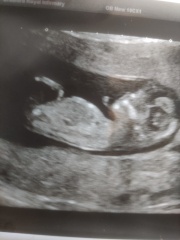 Boy or girl? 12 weeks scan