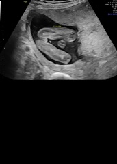 Is it REALLY looking like a girl?? May I have your opinion please?