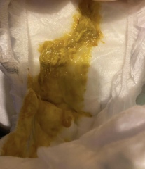 *warning picture* Intolerance , teething or something else