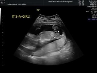Did they tell us the wrong gender?