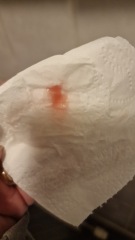 Is this start of mucus plug? Tmi pic