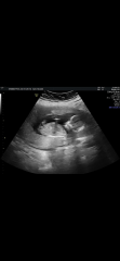 Gender Guesses?