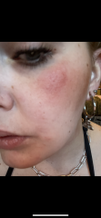 Can someone tell me what my rash might be