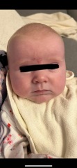 Possible milk allergy or what?