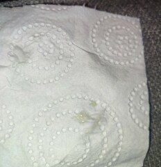 Yellow CM (TMI photo)