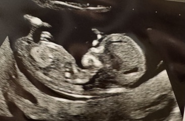 Boy or girl nub theory?? Xxxxx