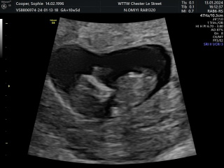 Boy or girl