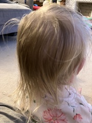 What to do about this baby bed head?