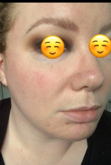 I want to start on Retinal/Retinol- scared of side effects and overwhelmed by choices