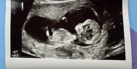 July / August babies let’s see your scans!
