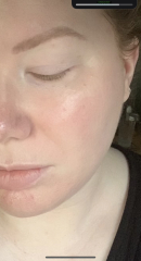 I want to start on Retinal/Retinol- scared of side effects and overwhelmed by choices