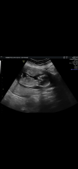 Gender Guesses?