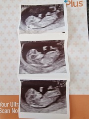 Do you want me to guess the sex? 12 week scans.