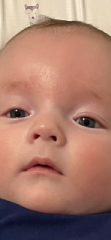 Eye problem?
