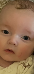 Eye problem?
