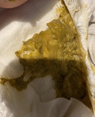 *warning picture* Intolerance , teething or something else