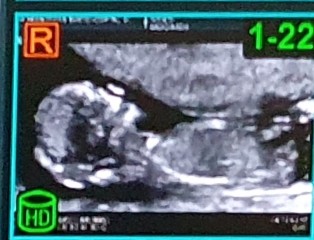 Gender/Nub Guesses (3pics).