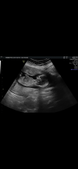 Gender Guesses?