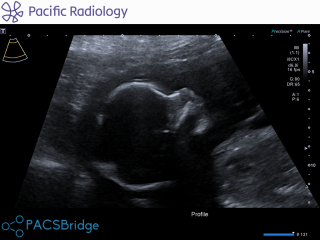 Freaking out need advice