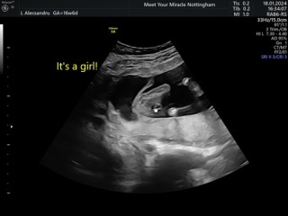Did they tell us the wrong gender?