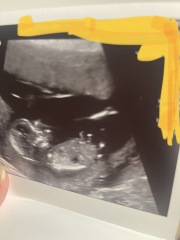 Boy or Girl?- Take a guess! :)